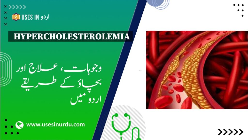 Hypercholesterolemia