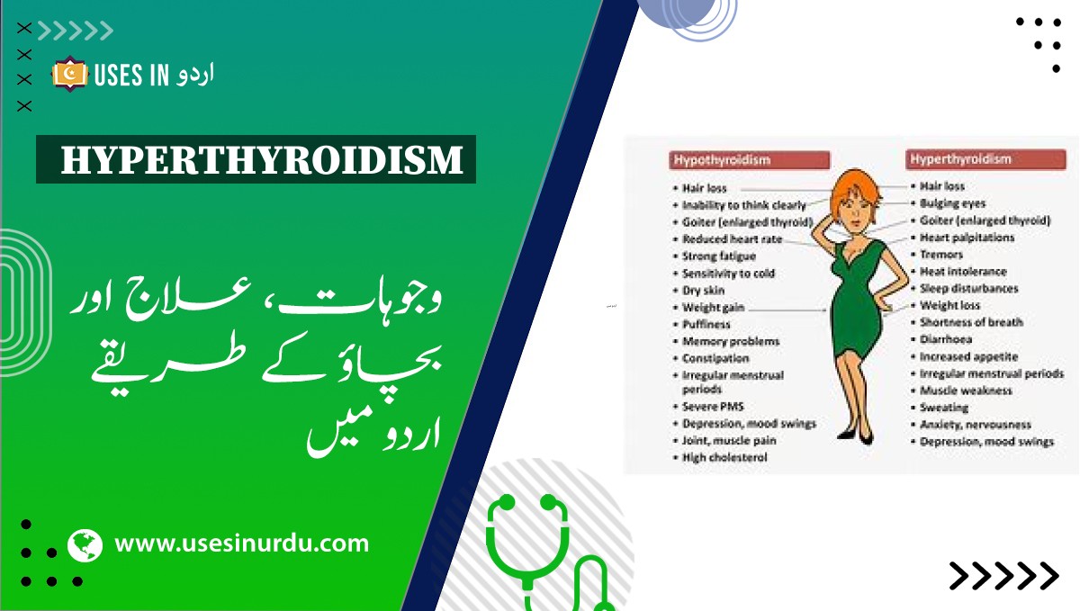 Hyperthyroidism