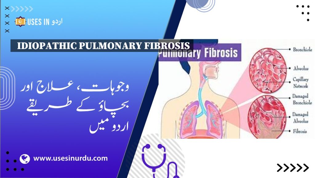 Idiopathic Pulmonary Fibrosis