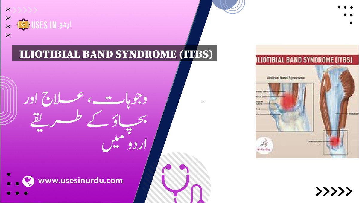 Iliotibial Band Syndrome (ITBS)