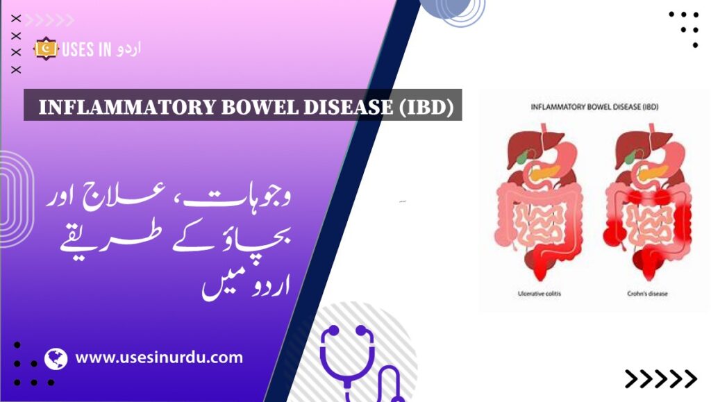 Inflammatory Bowel Disease (IBD)