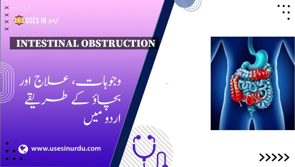 Intestinal Obstruction