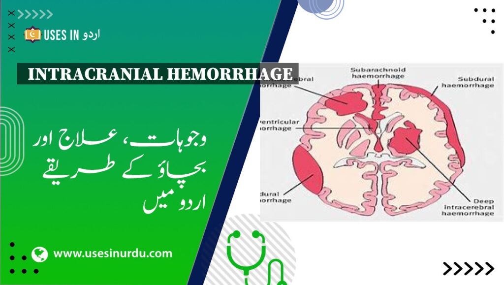 Intracranial Hemorrhage