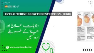 Intrauterine Growth Restriction (IUGR)