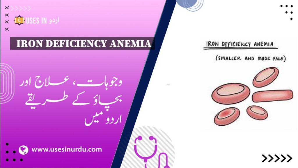 Iron Deficiency Anemia