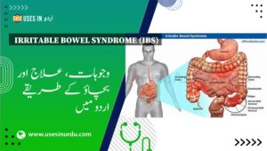 Irritable Bowel Syndrome (IBS)