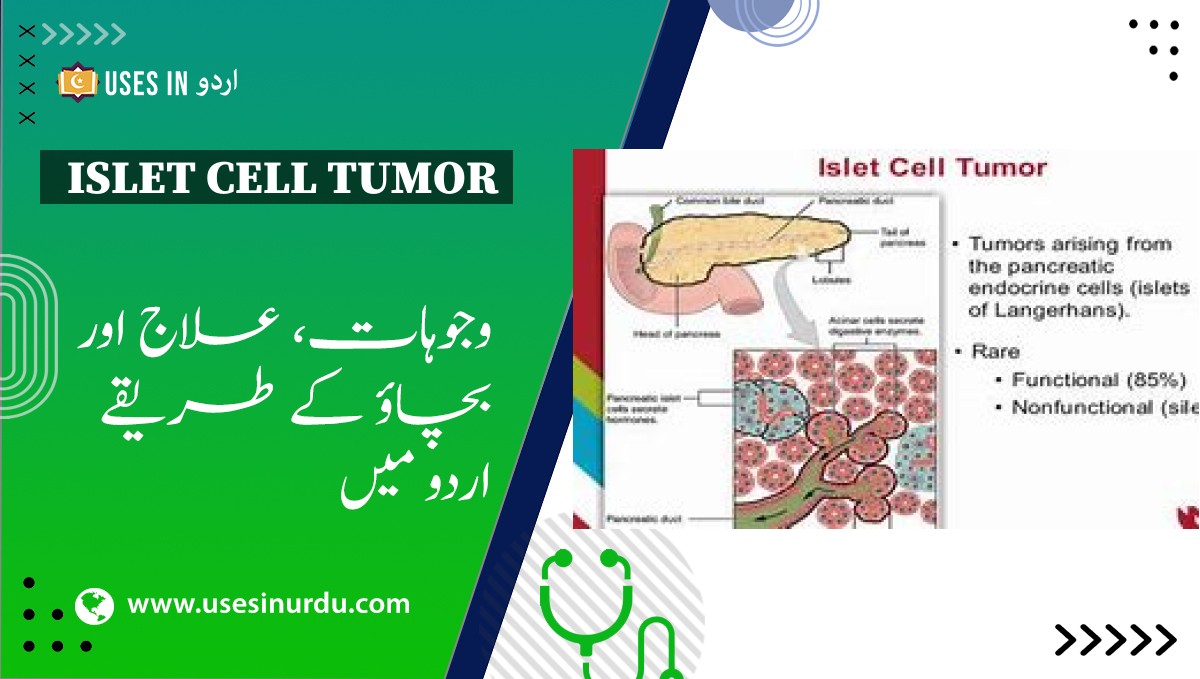 Islet Cell Tumor