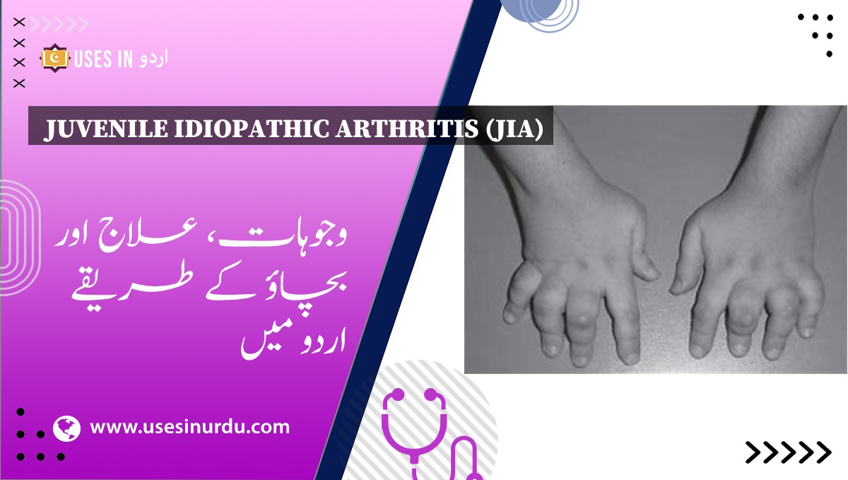 Juvenile Idiopathic Arthritis (JIA)