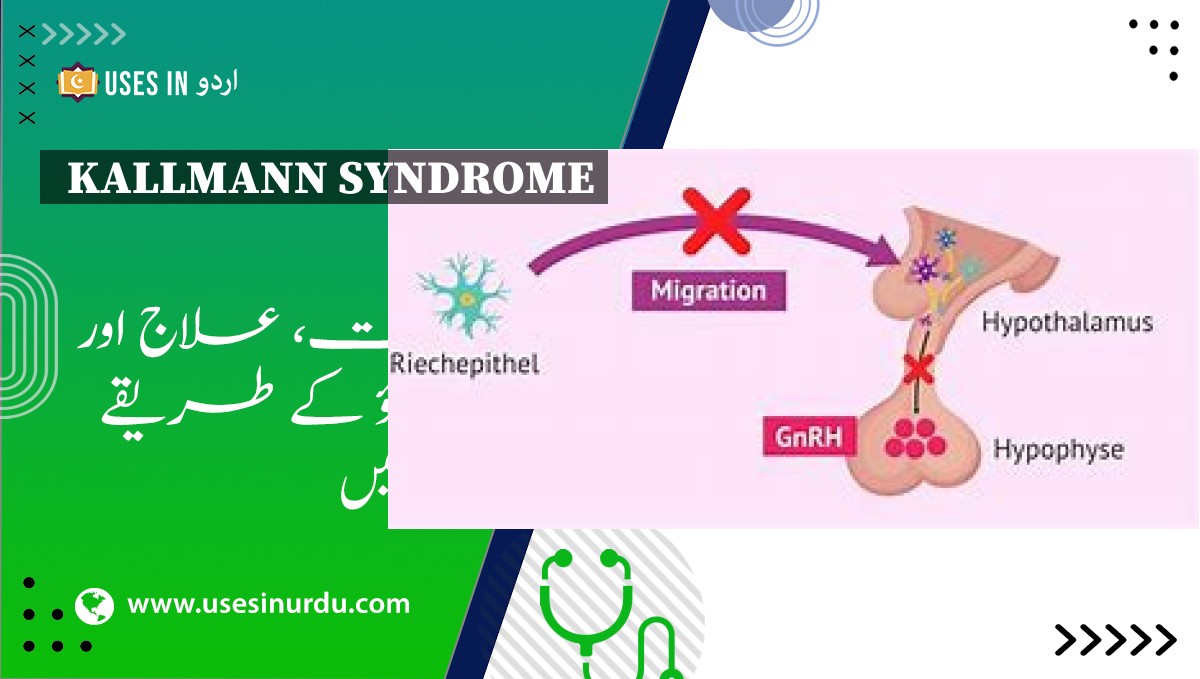 Kallmann Syndrome