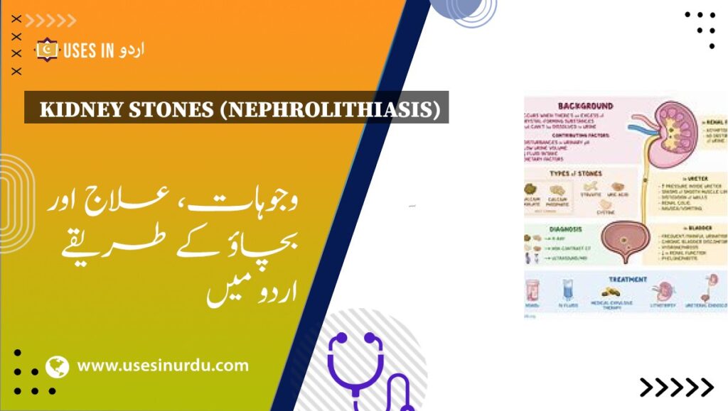 Kidney Stones (Nephrolithiasis)