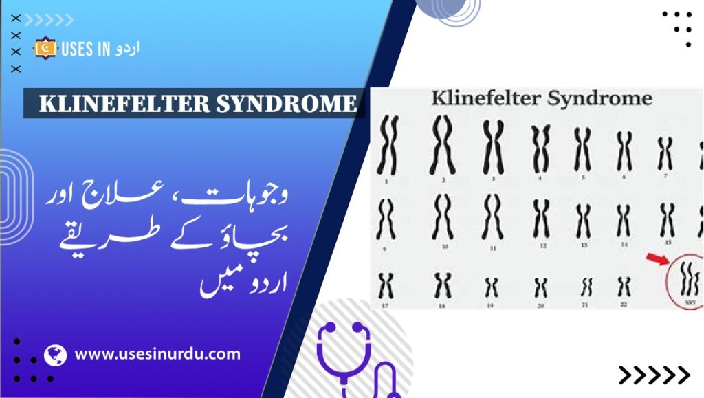 Klinefelter Syndrome