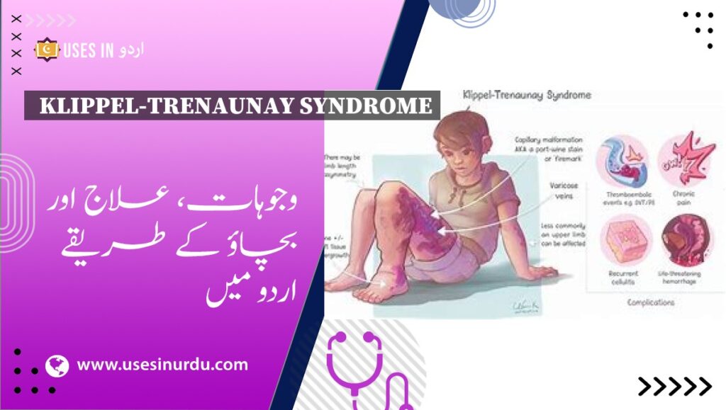 Klippel-Trenaunay Syndrome