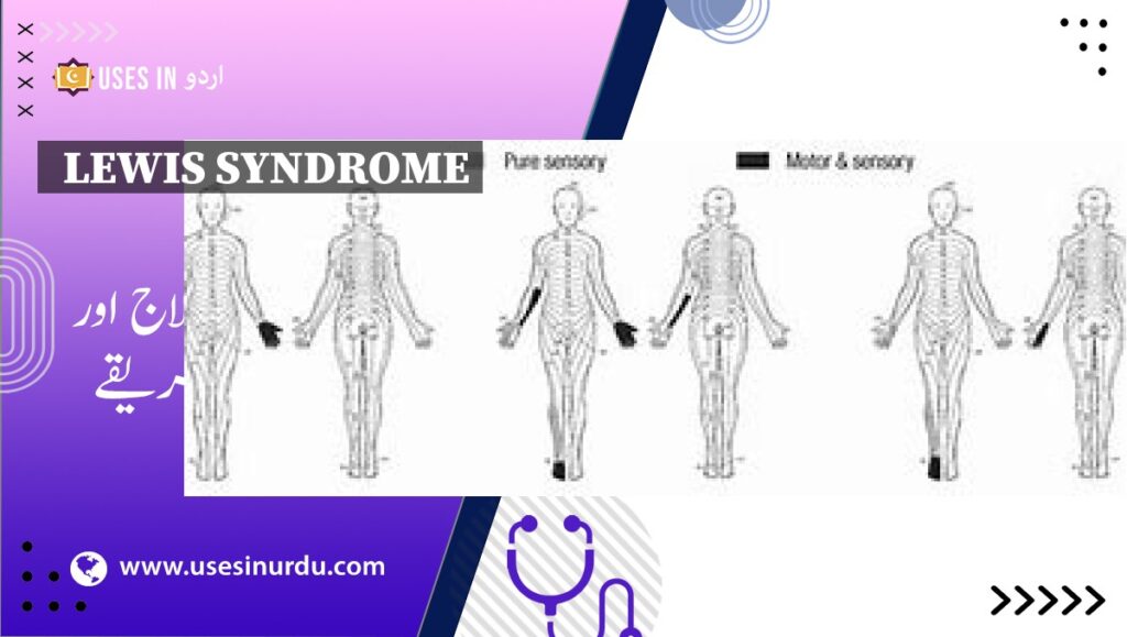 Lewis Syndrome