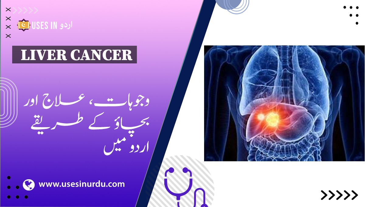 Liver Cancer