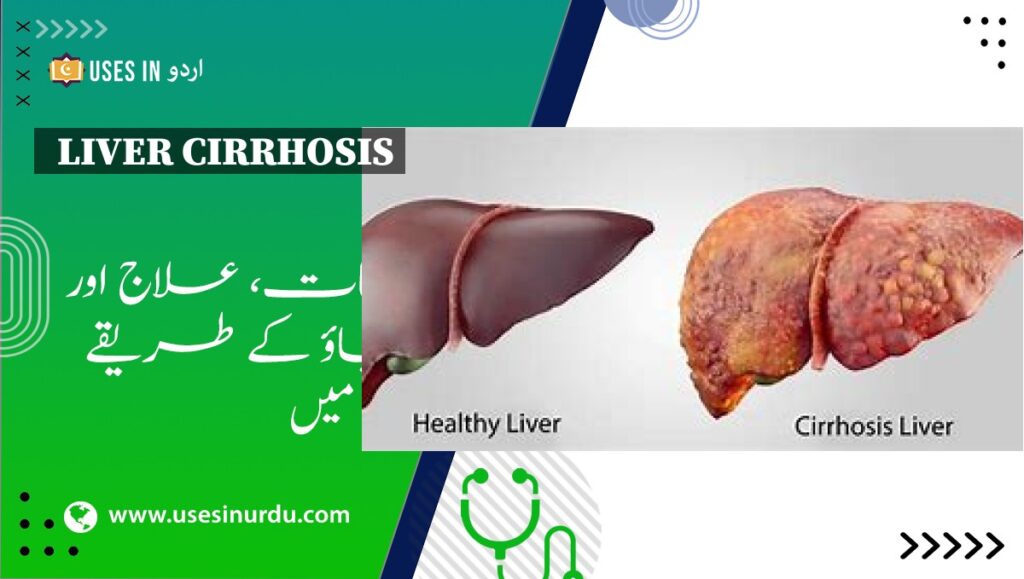 Liver Cirrhosis