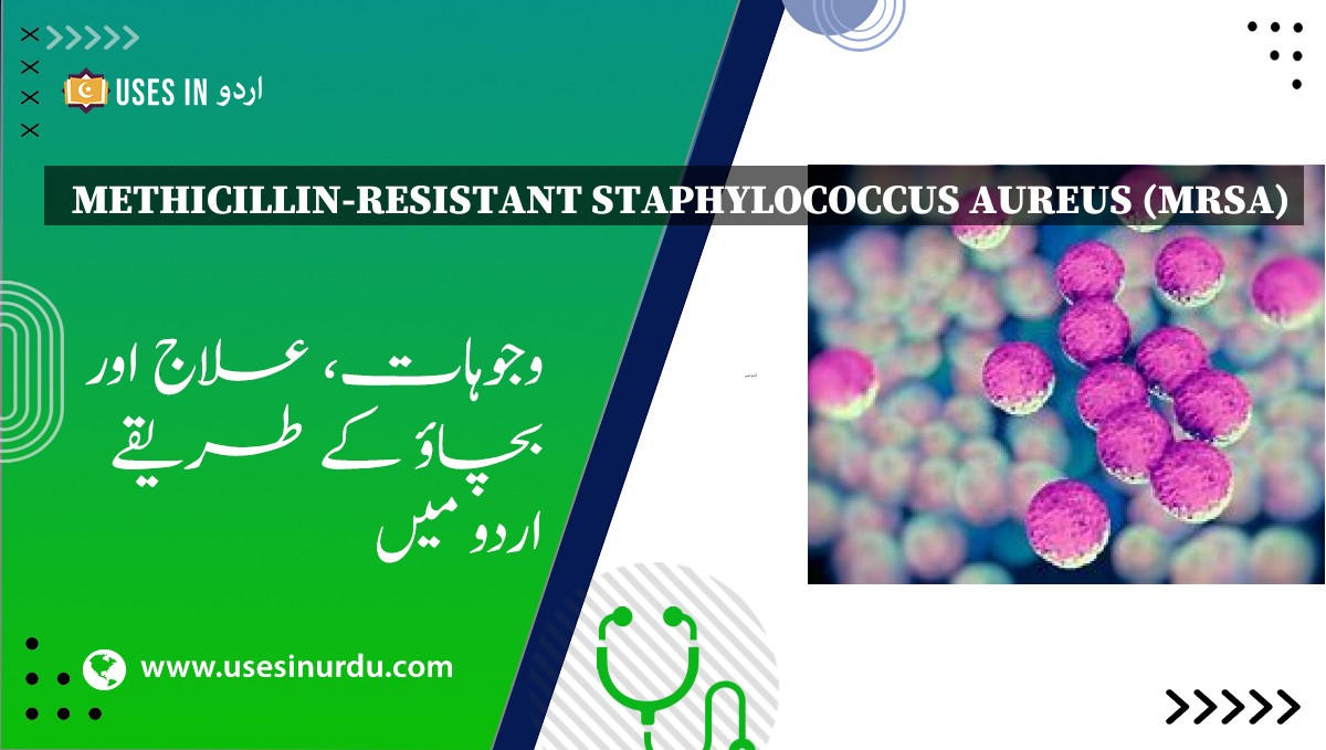 Methicillin-Resistant Staphylococcus Aureus (MRSA)