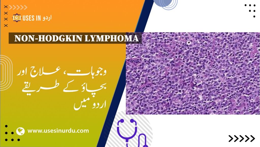 Non-Hodgkin Lymphoma