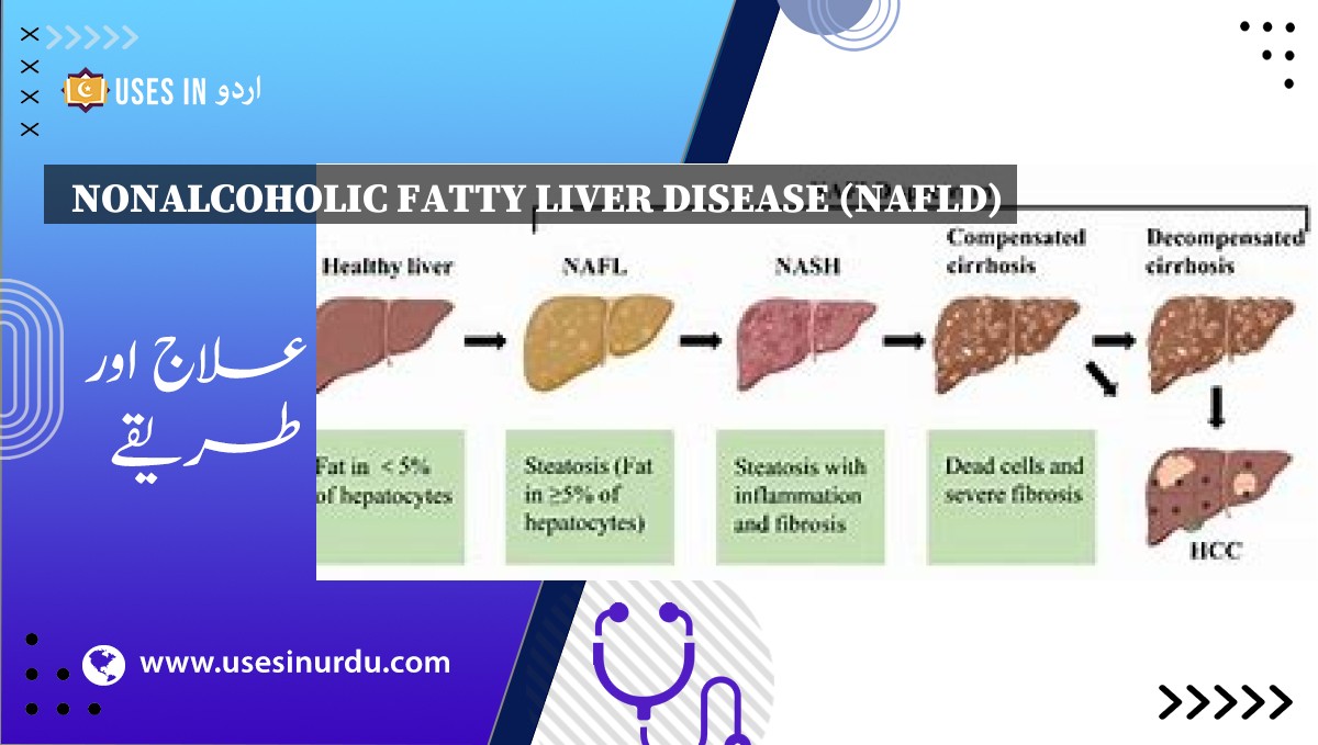 Nonalcoholic Fatty Liver Disease (NAFLD)