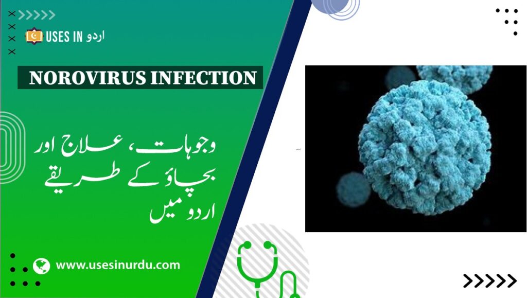 Norovirus Infection