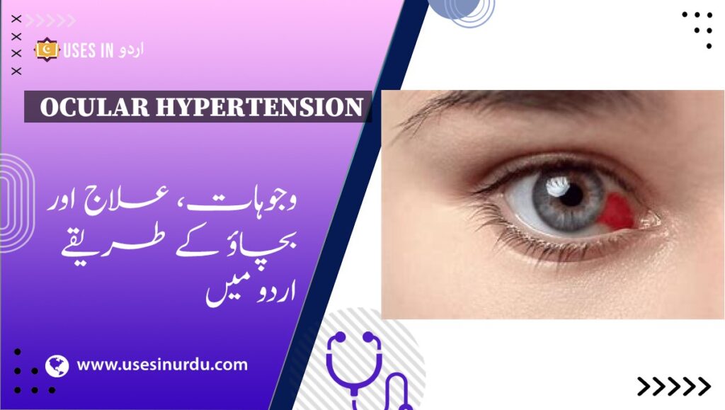 Ocular Hypertension