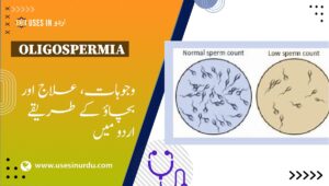 Oligospermia