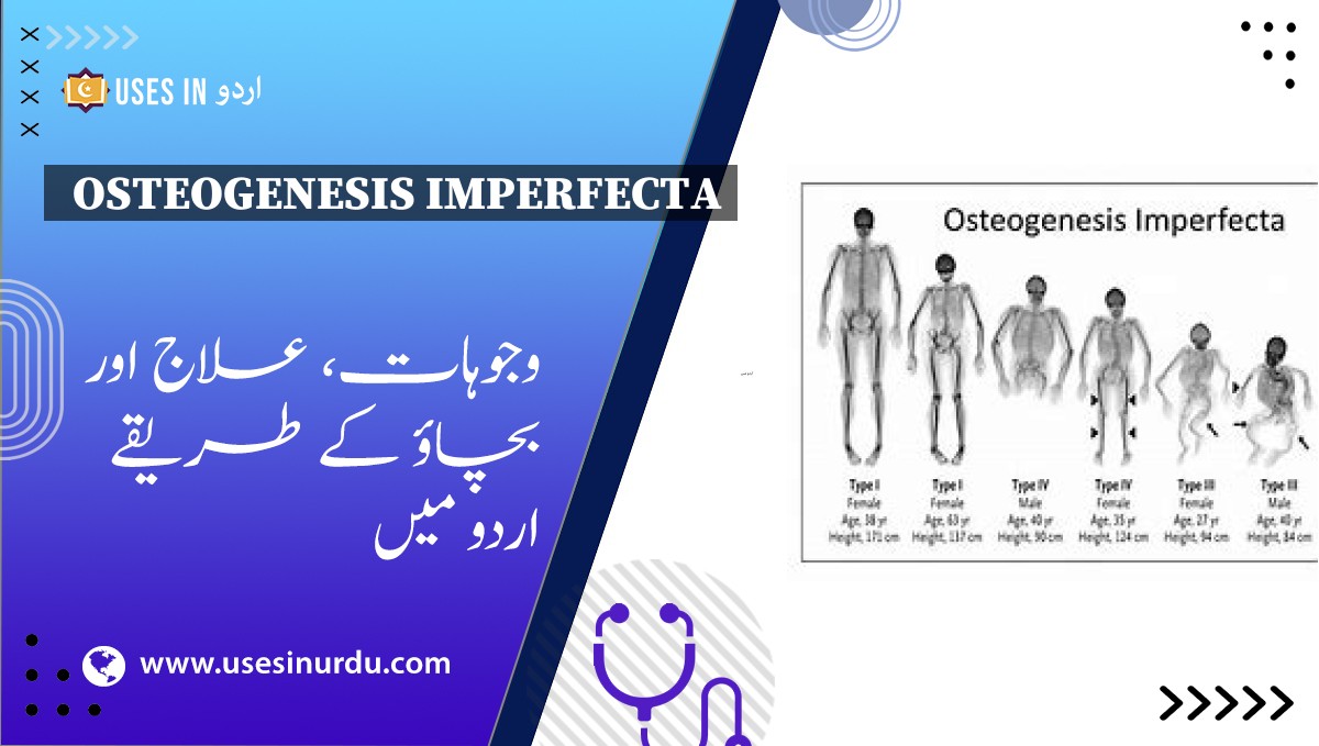 Osteogenesis Imperfecta