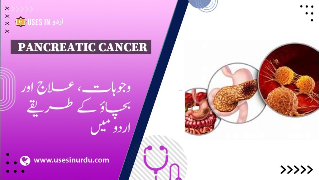 Pancreatic Cancer