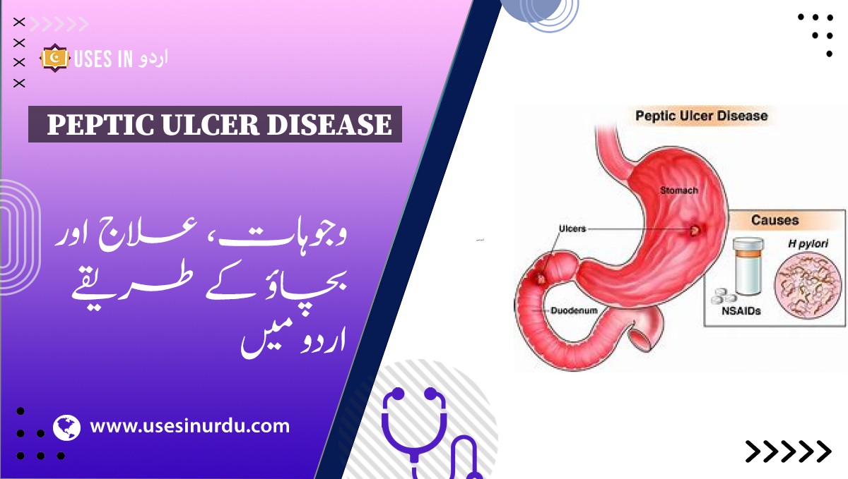 Peptic Ulcer Disease