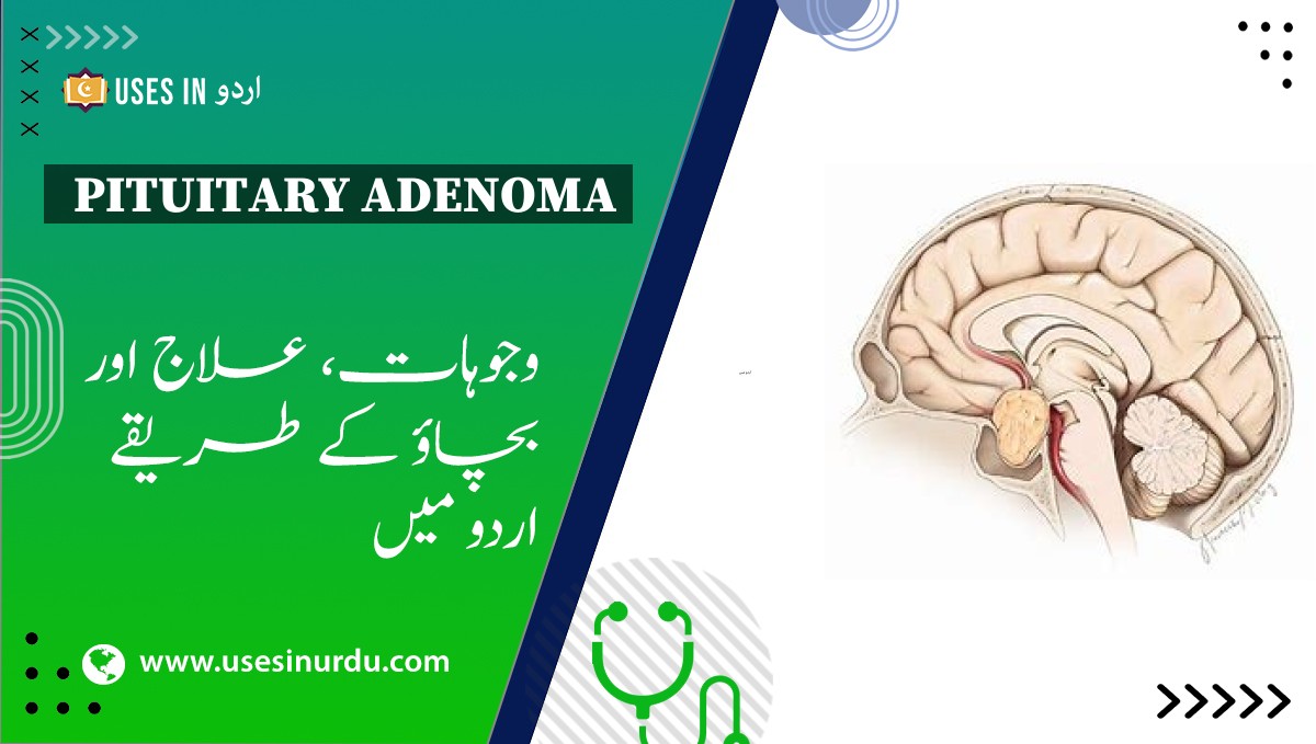 Pituitary Adenoma