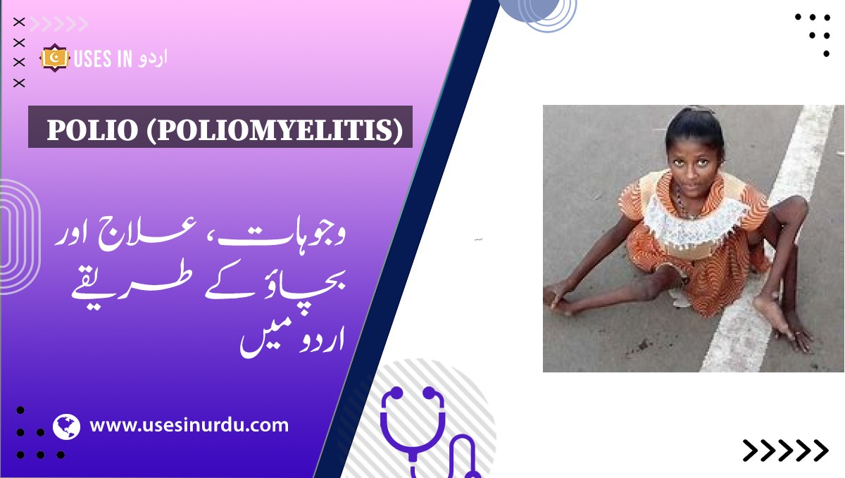 Polio (Poliomyelitis)