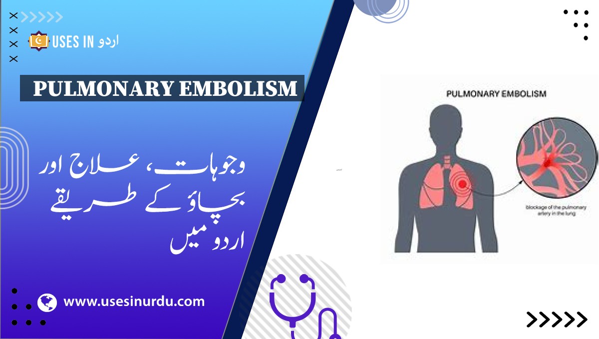 Pulmonary Embolism