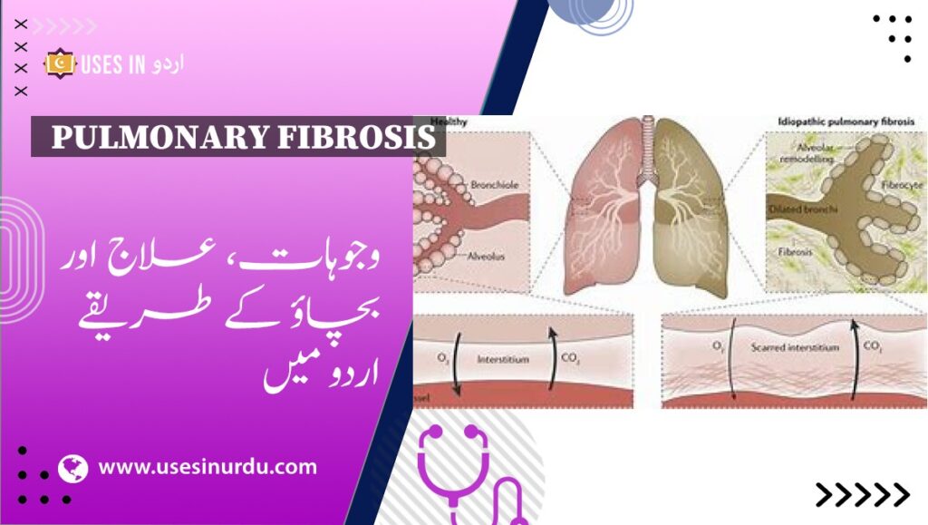 Pulmonary Fibrosis