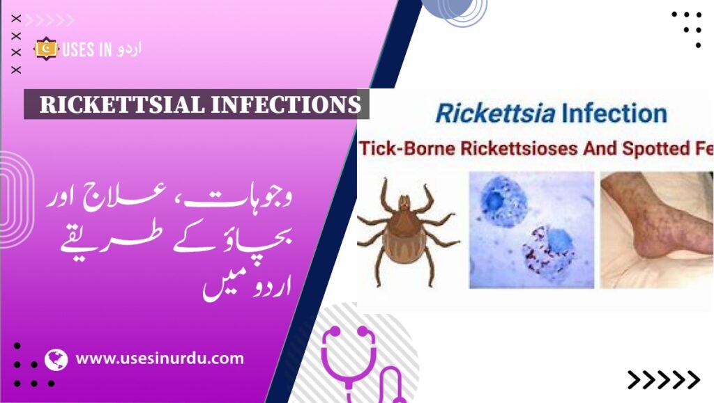 Rickettsial Infections