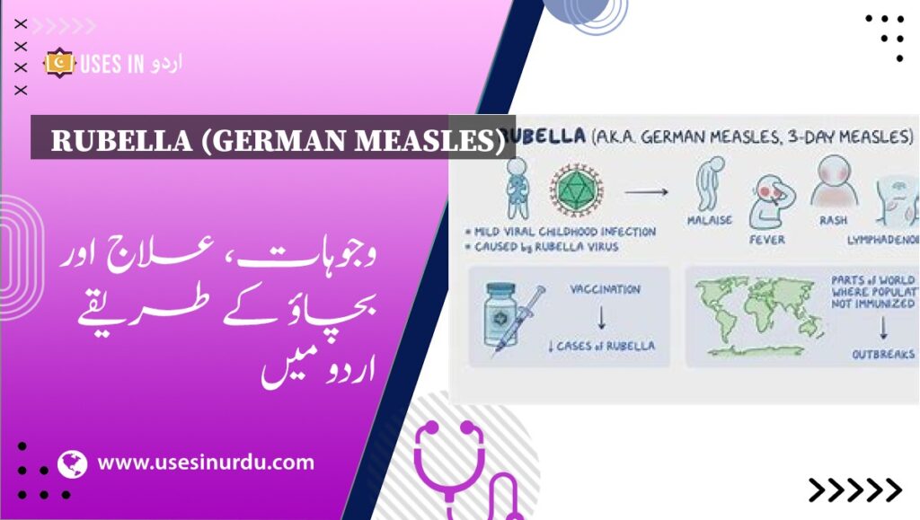 Rubella (German Measles)