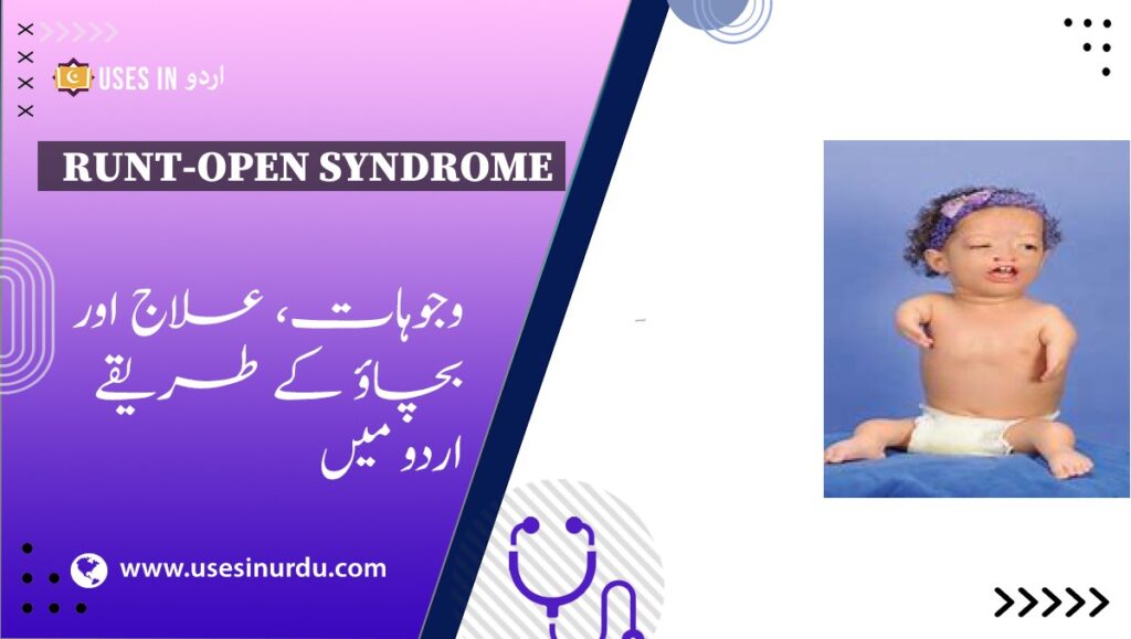 Runt-Open Syndrome