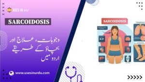 Sarcoidosis