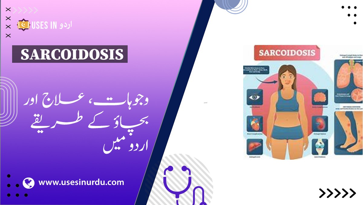 Sarcoidosis