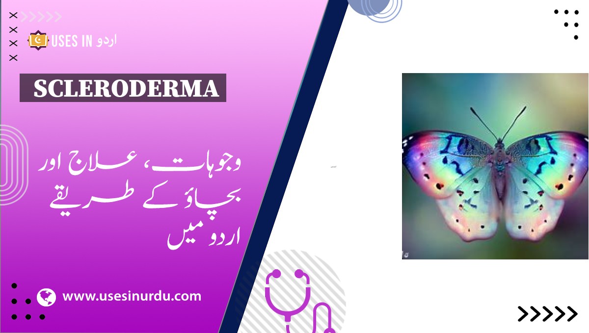 Scleroderma