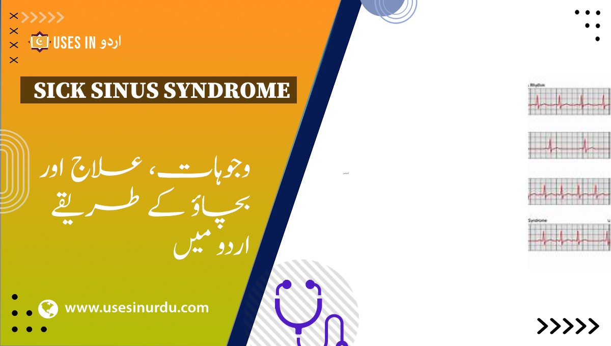 Sick Sinus Syndrome