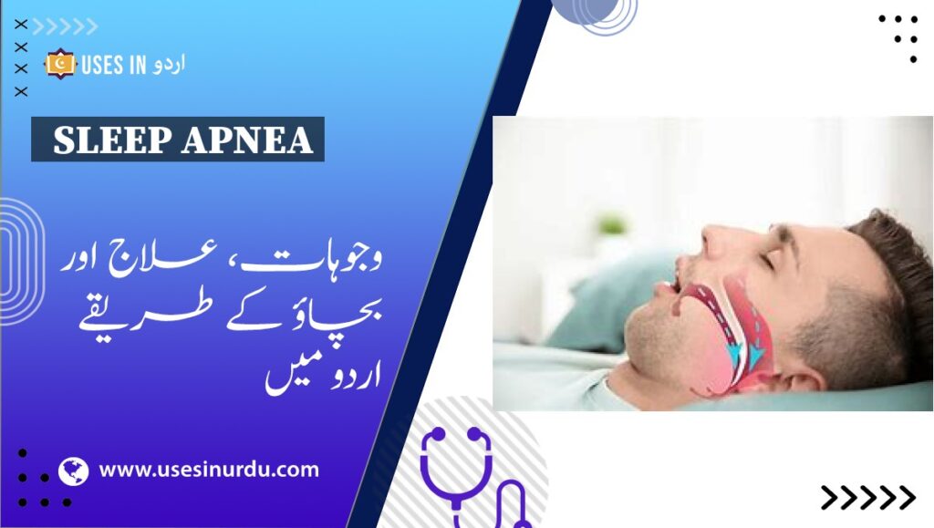 Sleep Apnea