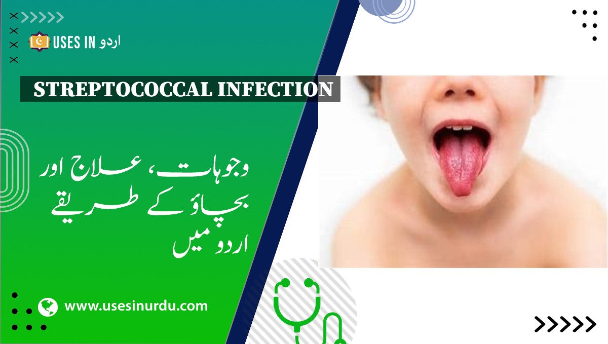 Streptococcal Infection