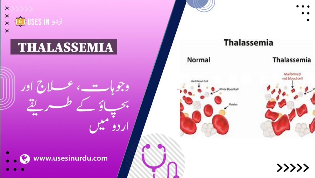 Thalassemia