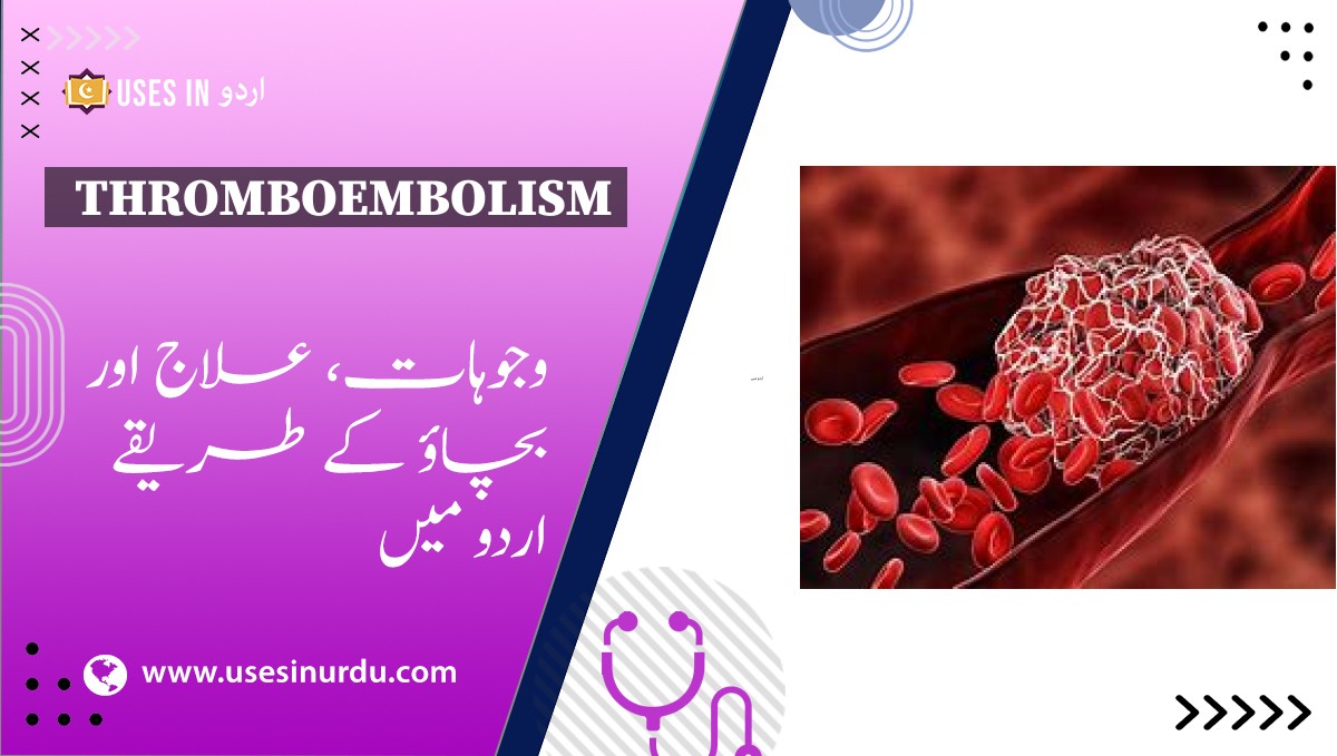 Thromboembolism