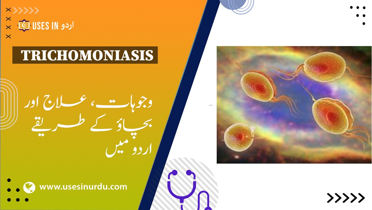 Trichomoniasis