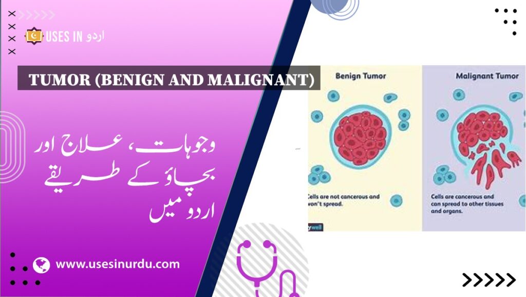 Tumor (Benign and Malignant)