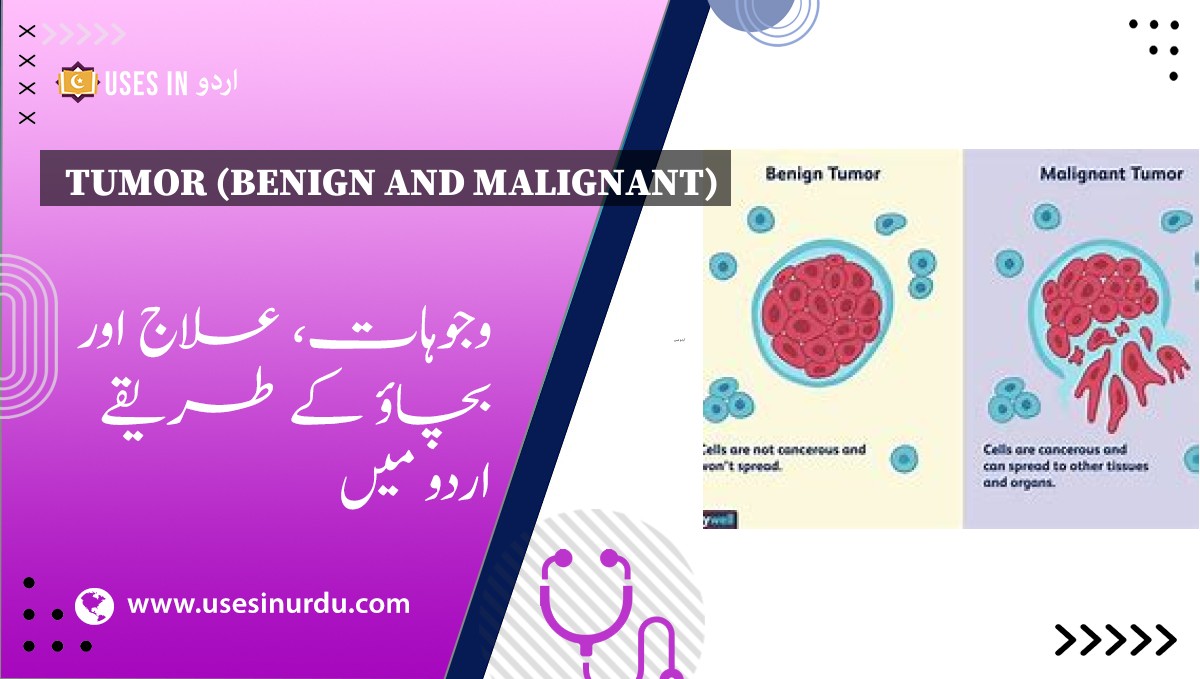 Tumor (Benign and Malignant)