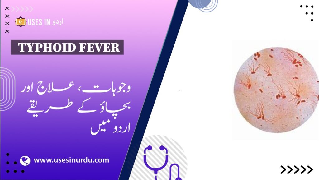 Typhoid Fever