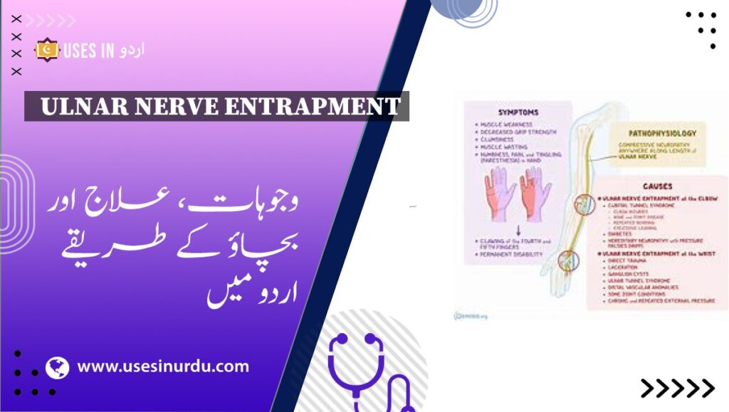 Ulnar Nerve Entrapment