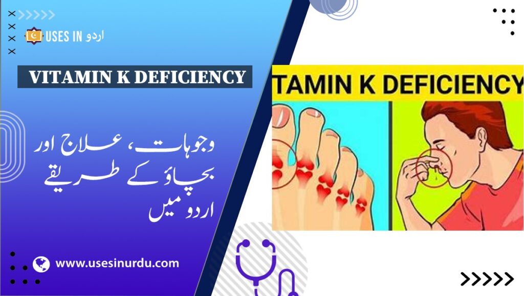 Vitamin K Deficiency