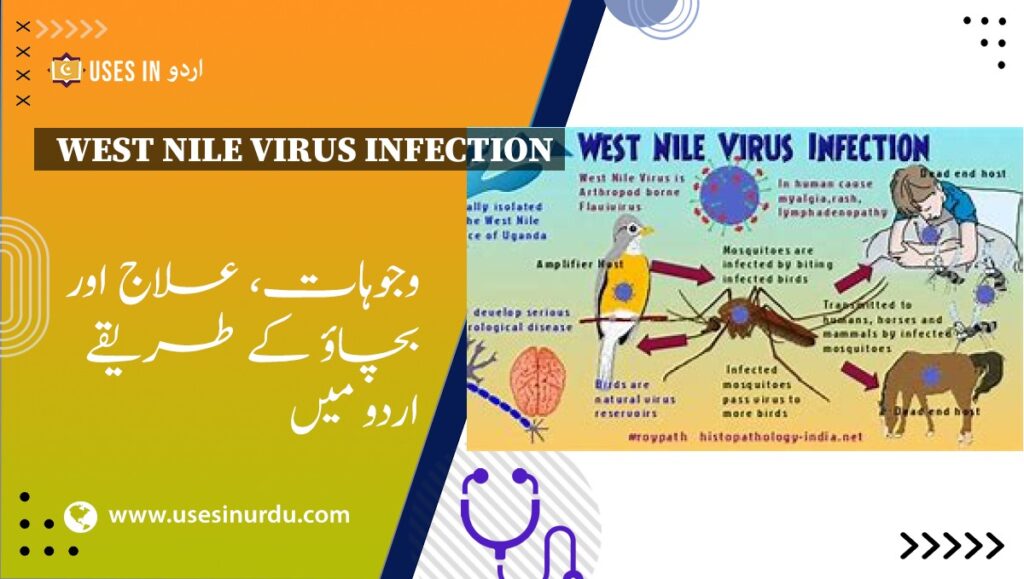 West Nile Virus Infection